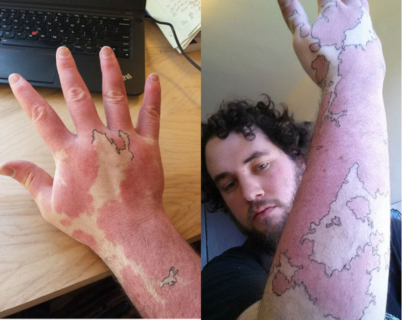 Люди с родимыми пятнами, которые не растерялись и сделали их частью татуировок