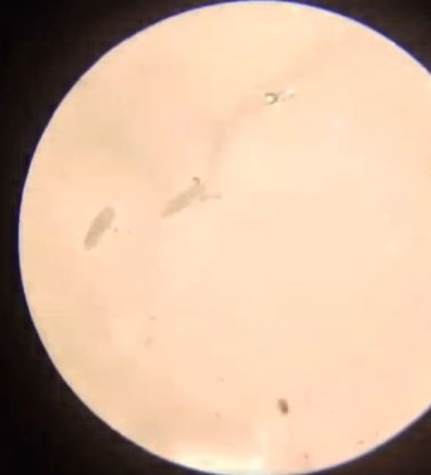 Попадание перекиси водорода в рану, кишащую бактериями - «Прикольные картинки»