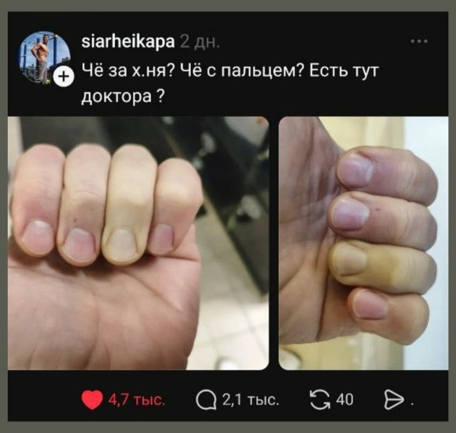 Есть тут доктора? Что с пальцем? - «Прикольные картинки»